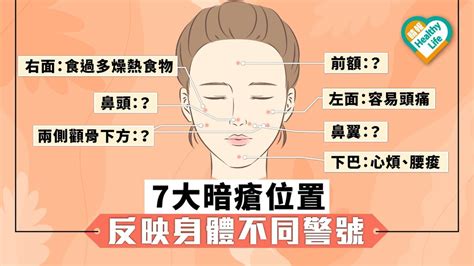 下爬生暗瘡|下巴暗瘡位置意味什麼？中西醫看法大不同！